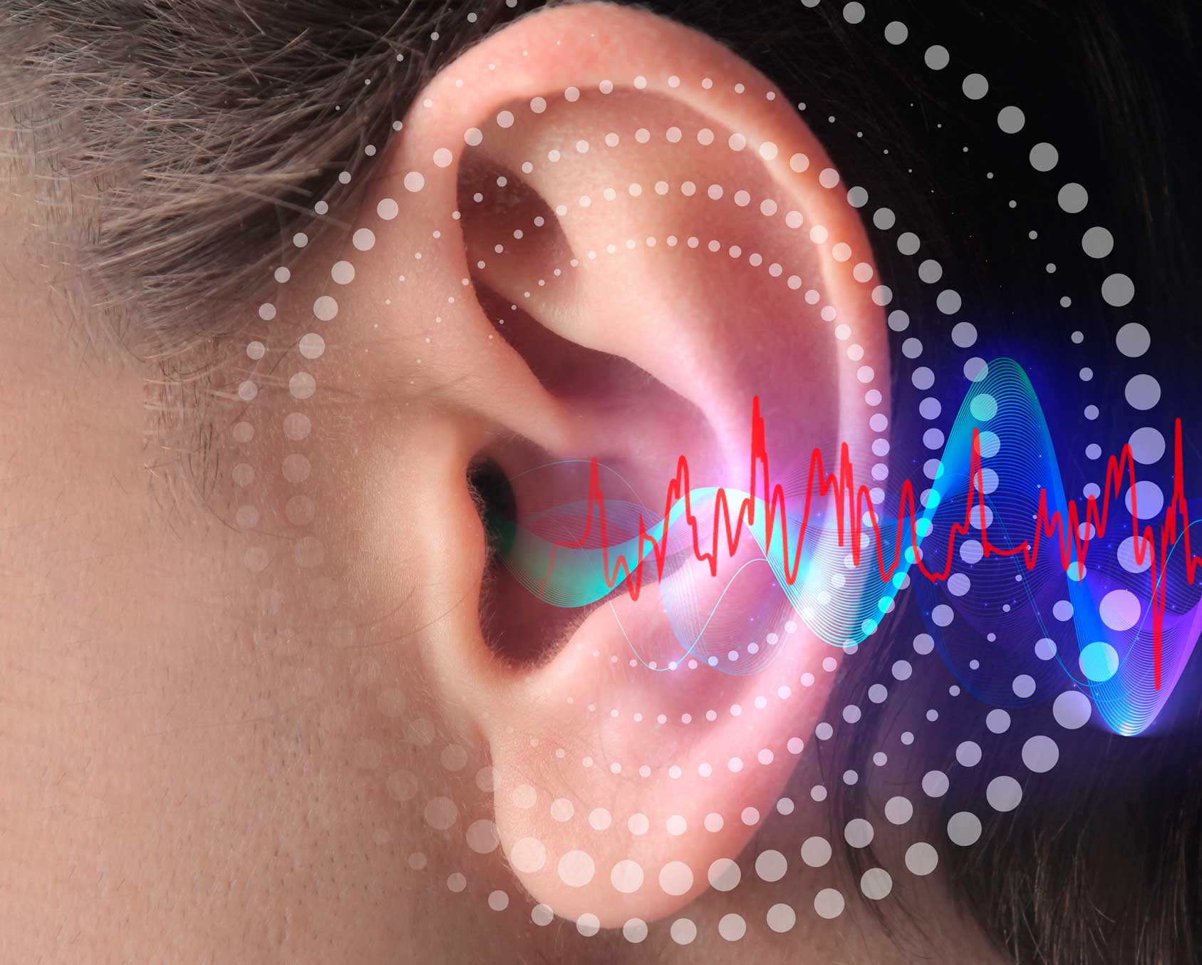 Deficiencia-Auditiva_capedinhperu.org